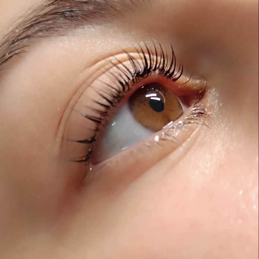 Foto de cejas después